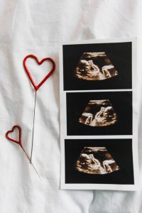 التغلب علي العقم