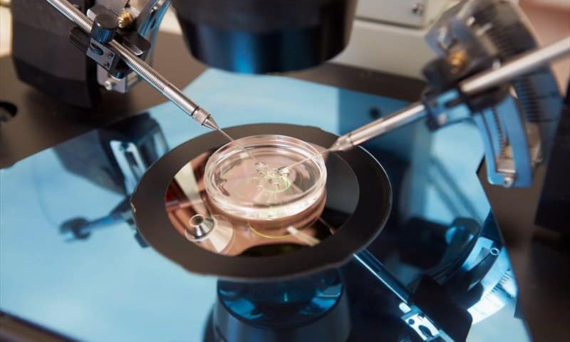 أقصي سن للحقن المجهري