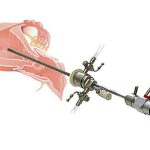 المنظار الرحمي