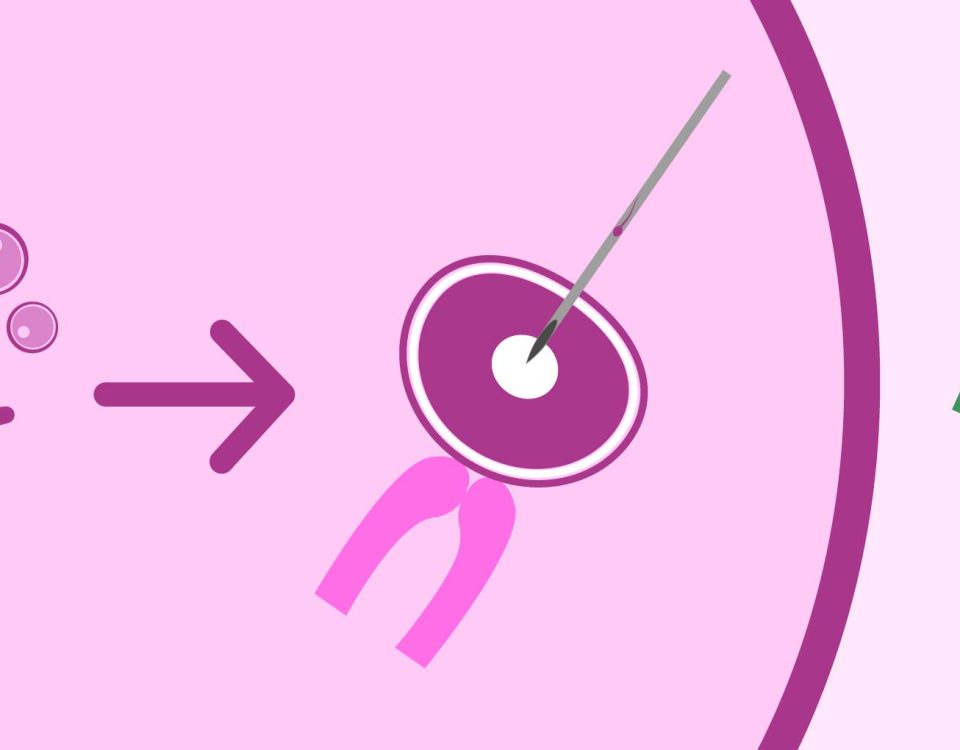 تكلفة الحقن المجهري في السعودية