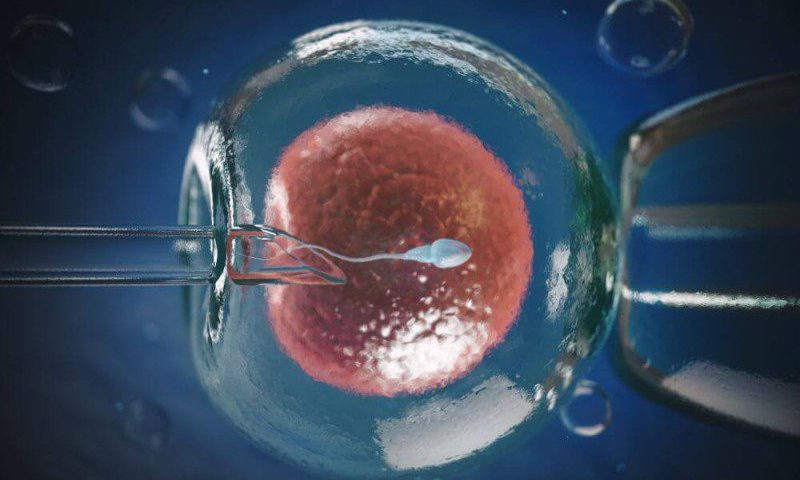 عمليه الحقن المجهري في الرياض