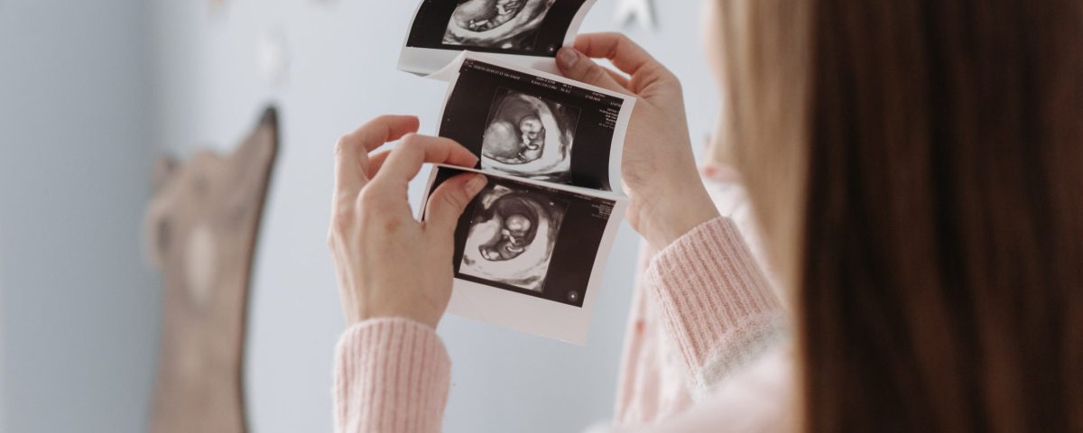 تخفيض عدد الأجنة لفترة حمل بلا مشاكل