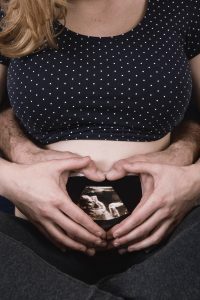 الإجهاض المتكرر