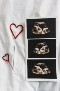 تحليل الاستراديول