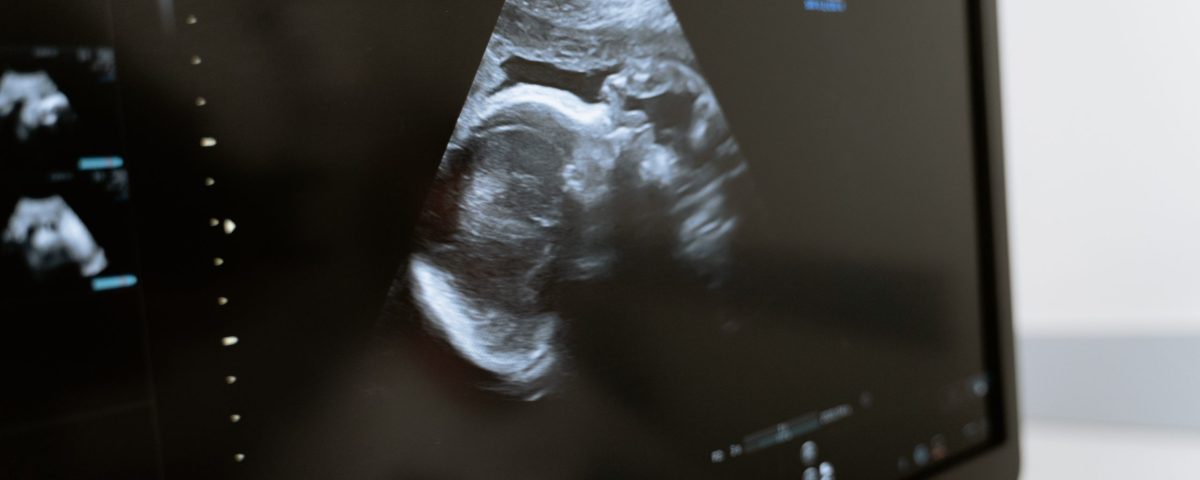 الصيام للحامل