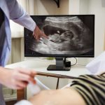 ولادة قيصرية بدون ألم