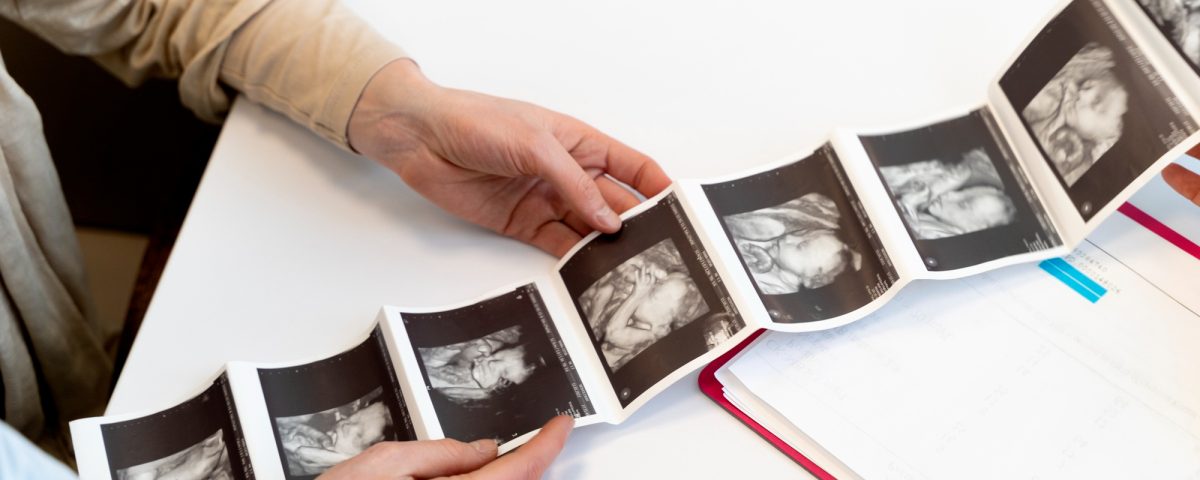 مراحل تكوين الجنين