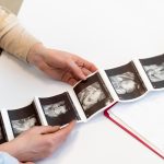 مراحل تكوين الجنين