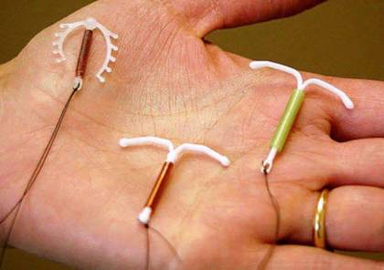 أنواع لولب منع الحمل