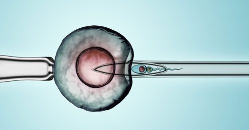 هل يحدث حمل طبيعي بعد فشل الحقن المجهري؟