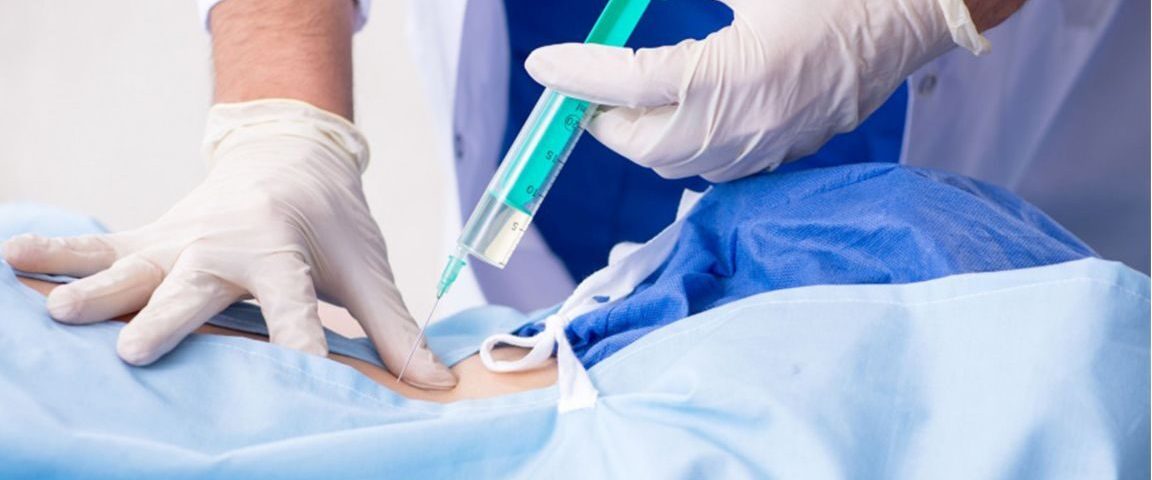 التخدير أثناء الولادة