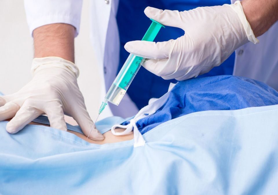 التخدير أثناء الولادة