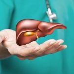 الركود الصفراوي في الحمل