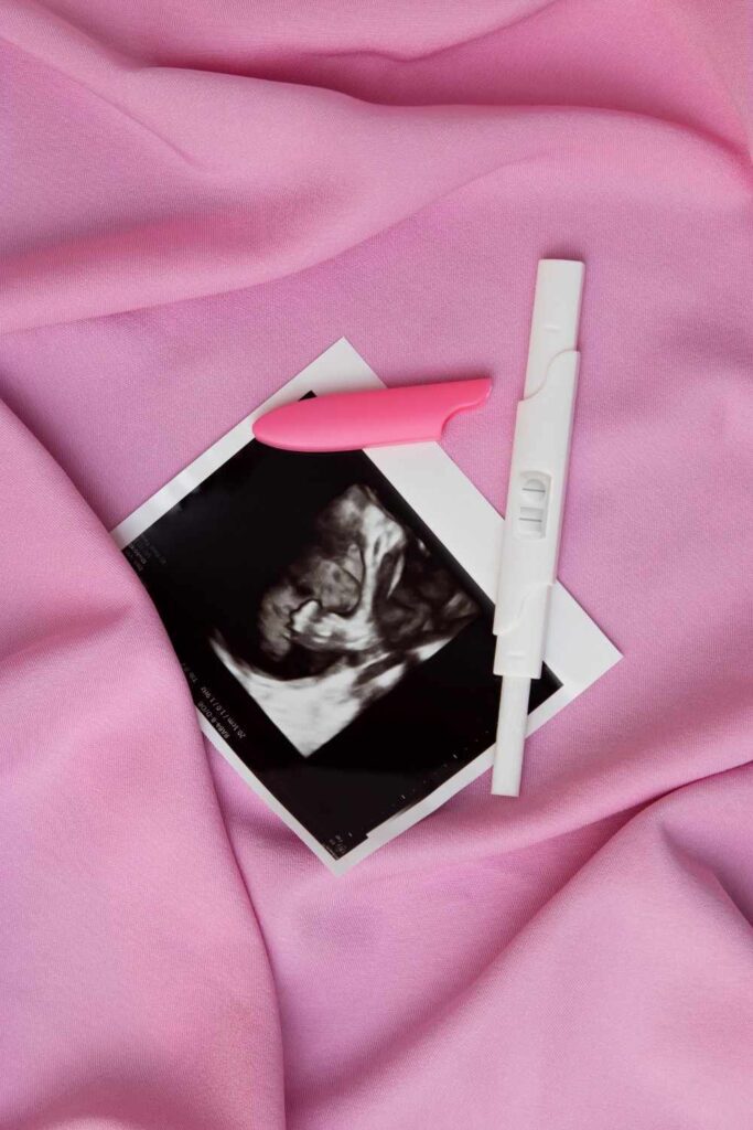 السقوط الرحمي