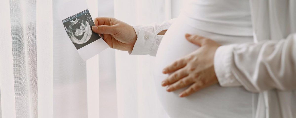 متلازمة داون