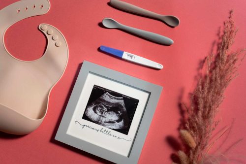 الذئبة الحمراء والحمل.هل يمكن ان اصبح أم وانا مريضة ذئبة حمراء؟