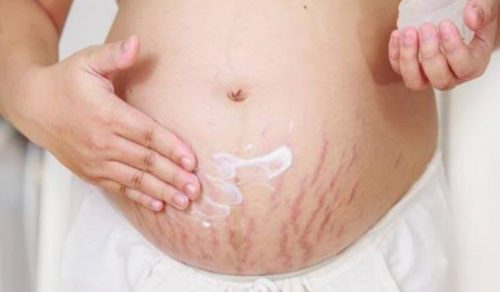 نصائح لتجنب ترهل الجلد بعد الولادة