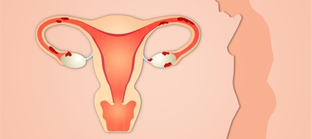 تغيرات الأعضاء التناسلية بعد الولادة