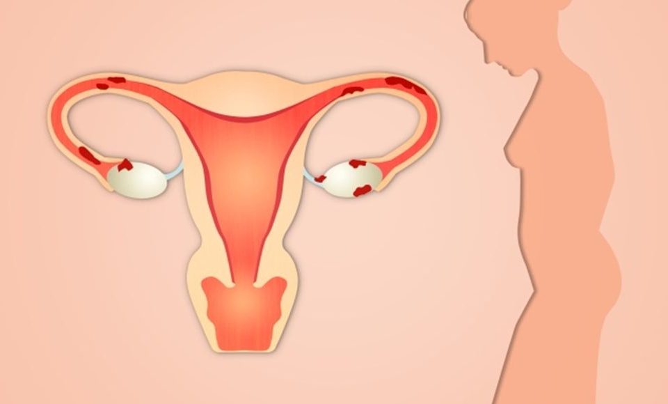 تغيرات الأعضاء التناسلية بعد الولادة