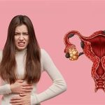 أكياس الشوكولاتة