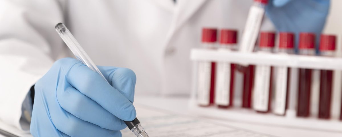 أهم التحاليل قبل الحقن المجهري