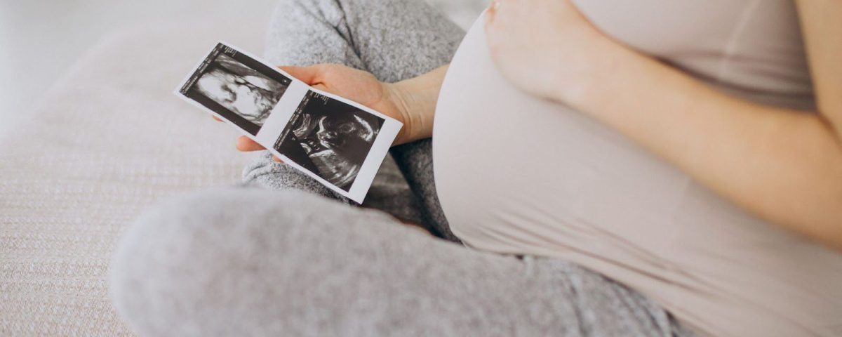 ربط عنق الرحم بعد الحقن المجهري