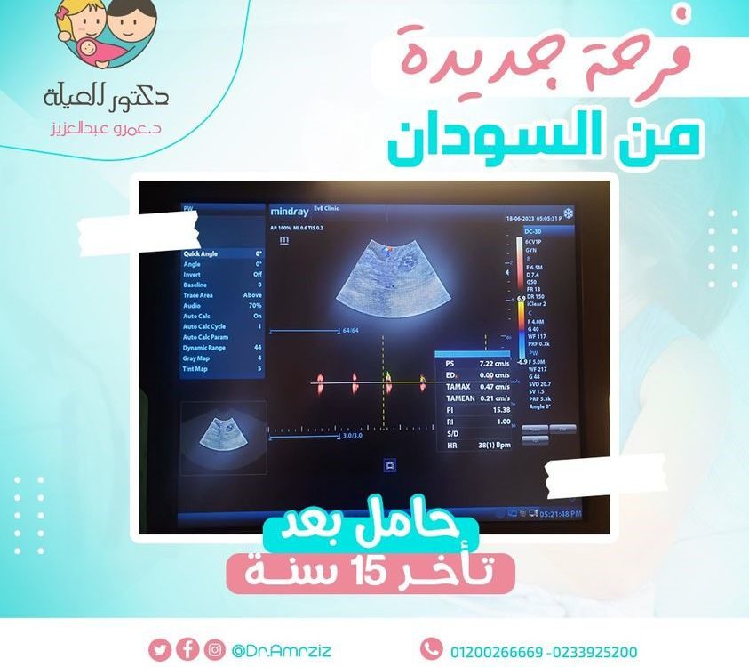 حامل بعد ضعف مخزون المبيض