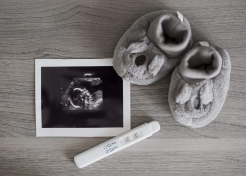 أعراض الحمل بعد الحقن المجهري| إليكِ الدليل الشامل