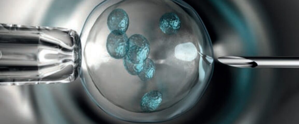 البروتوكول القصير في الحقن المجهري| رحلة أقصر نحو الأمومة