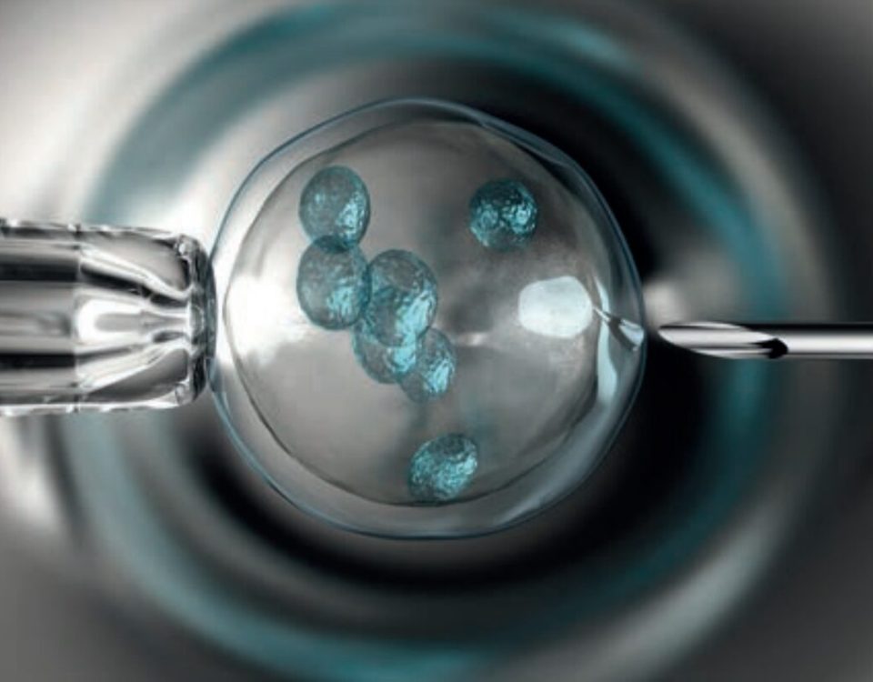 البروتوكول القصير في الحقن المجهري| رحلة أقصر نحو الأمومة