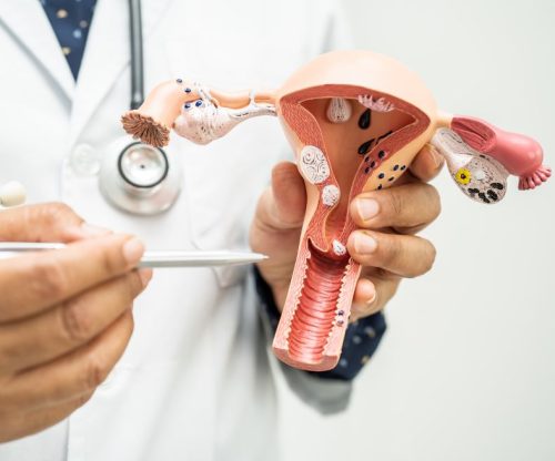 سرطان عنق الرحم| حقائق يجب أن تعرفيها