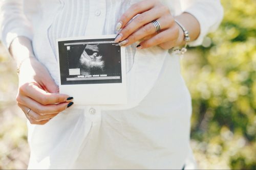 نصائح للحامل في الشهر الأول بعد الحقن المجهري| دليلك الشامل