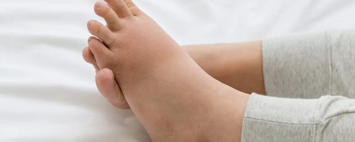 لماذا تشعر المرأة بتنميل القدمين بعد الولادة؟